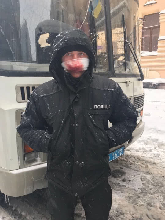 В Киеве под ВР жестко зачистили МихоМайдан. Задержано более 100 человек, есть раненные