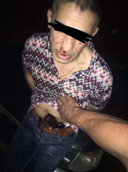Ствол в трусах и лихие 90-е в голове: в Одессе ночью криминальный "турист" застрелил человека