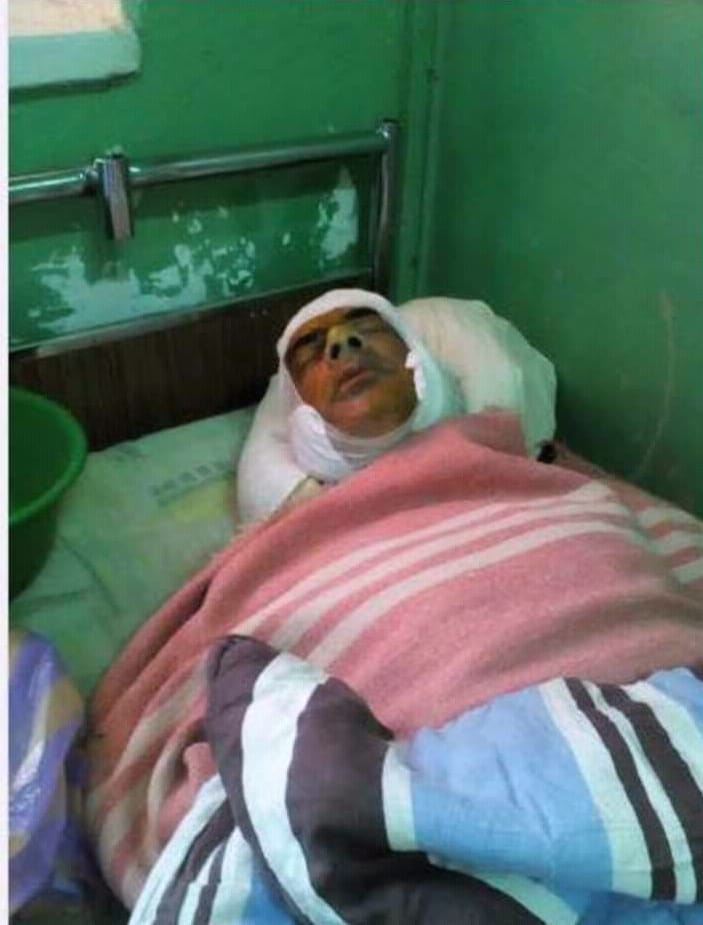 Итальянцу в Аккермане плеснули в лицо кислотой - иностранец в больнице в тяжелом состоянии с сильным ожогом глаз