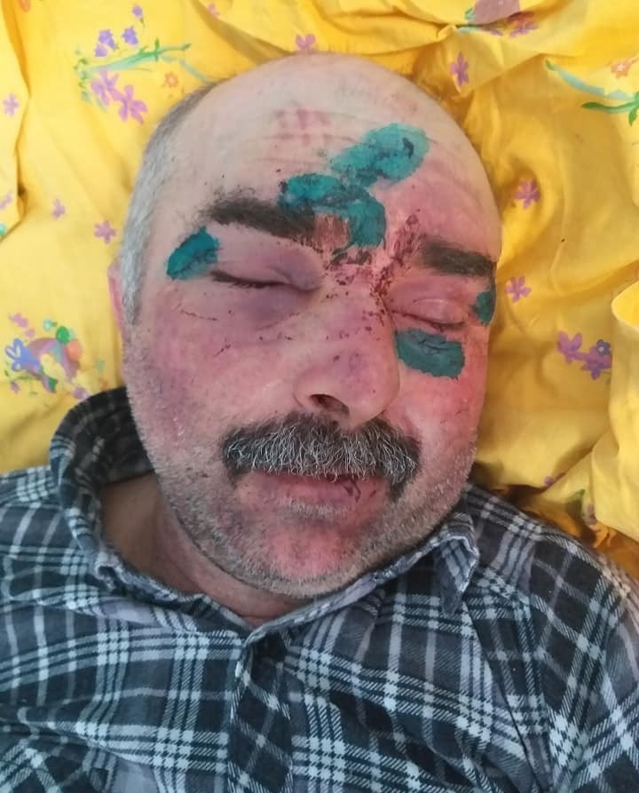 Измаильский район: в Утконосовке жестоко избили охранника сельсовета