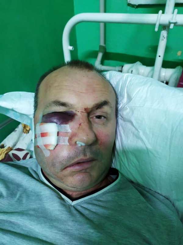 В Белгороде-Днестровском неизвестные напали на начальника УЖКХ