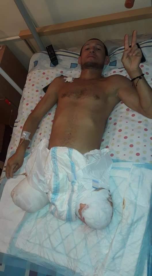 Житель Килийского района потерял обе ноги из-за падения с большой высоты на стройке
