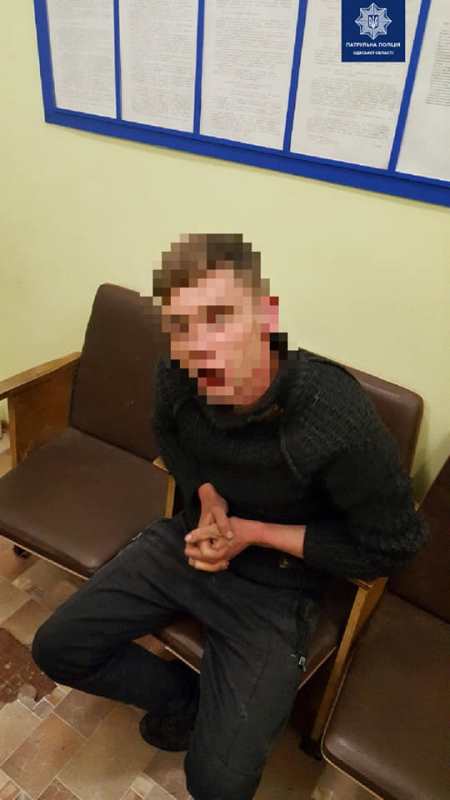 Пьяный дебошир в Измаиле поджег авто, забор и разбил окна в гостинице по улице Гагарина