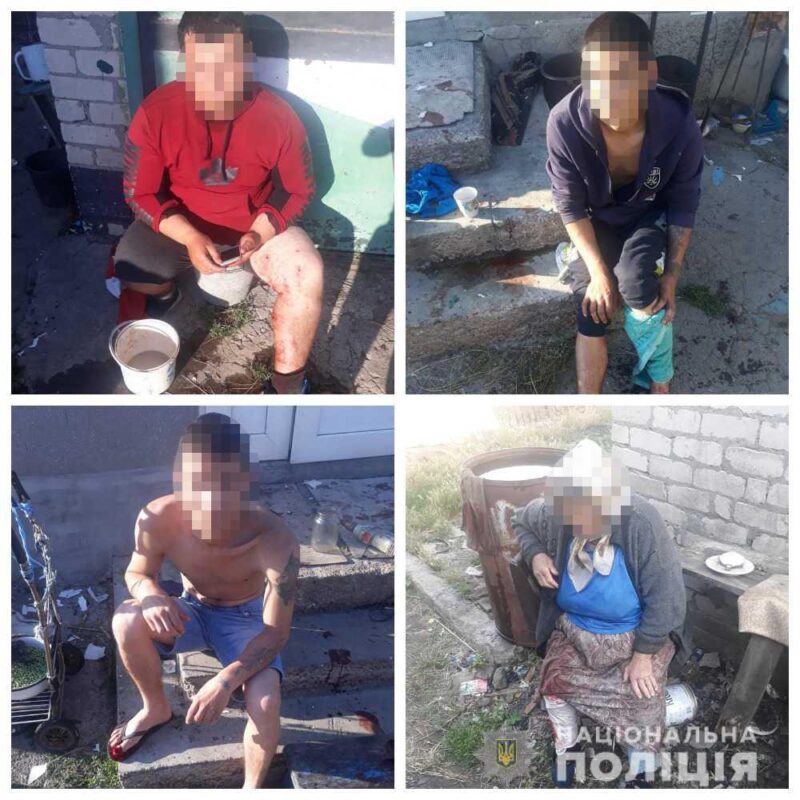 В результате взрыва гранаты в Одесской области ранения получили пять человек