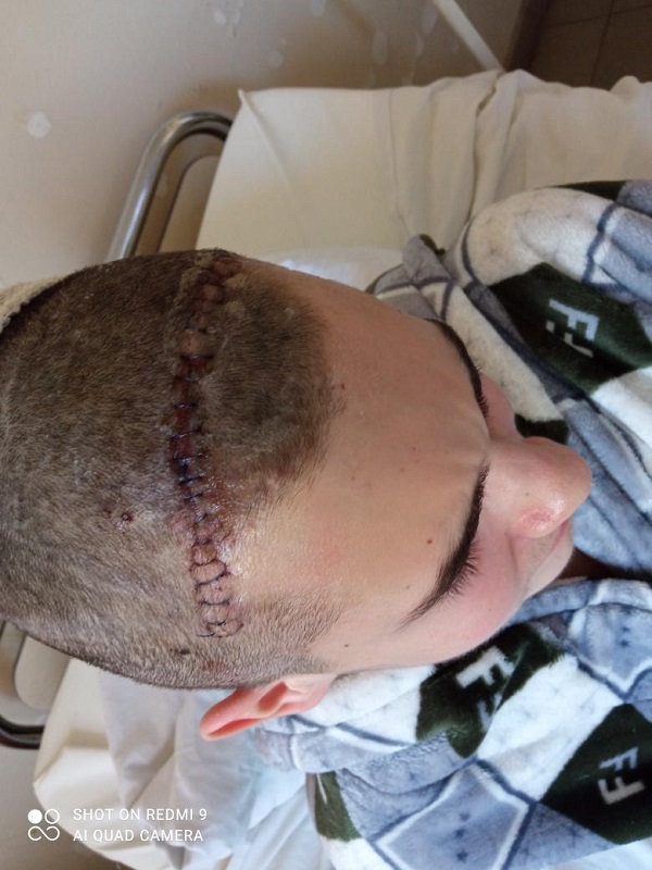 У 18-летнего жителя Аккермана обнаружили агрессивную форму рака мозга: семья собирает деньги на лечение