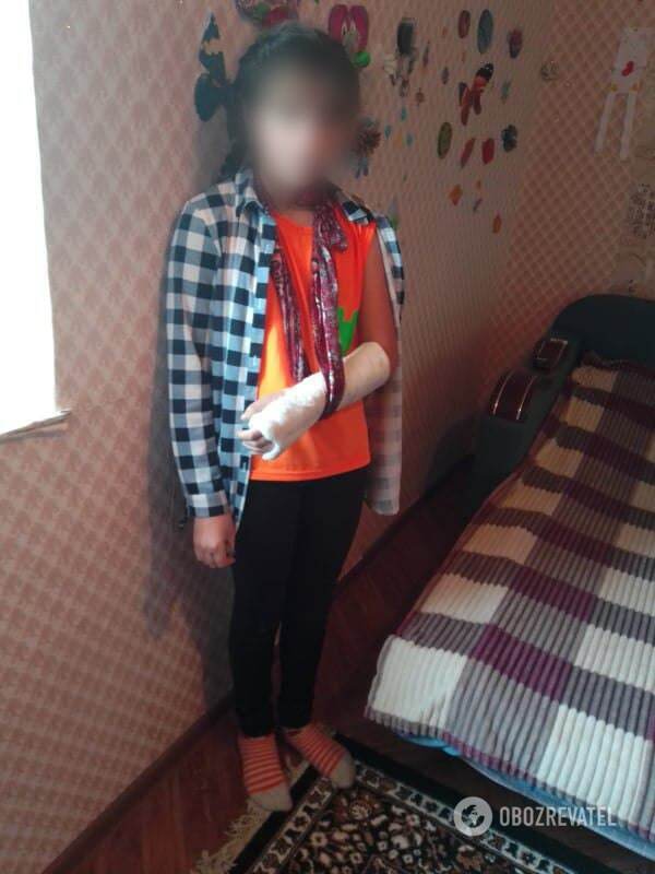 Скандал в школе в Одесской области: девочка сломала руку, а ее тихо отпустили домой