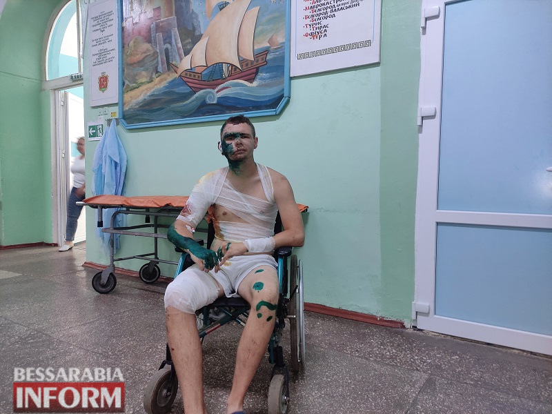 "Мы же украинцы, мы же бессарабы!": пострадавшие от ракетной атаки в Сергеевке постепенно приходят в себя после пережитого (репортаж из больницы)