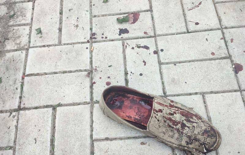 Щонайменше 5 загиблих та 13 поранених: поруч із зупинкою в Миколаєві прилетів російський снаряд (Фото +18)