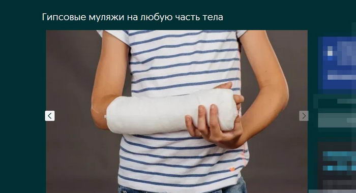 На любую часть тела: в Одессе предлагают наложение фейкового гипса для мужчин, чтобы ходить "без приключений" на Привоз