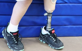Саша возвращается к активной жизни: девочка из Залива, потерявшая ногу от обстрела россиян, получила протез