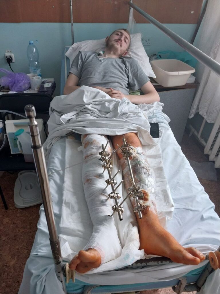 20-летнему защитнику из Бессарабии, получившему тяжелое ранение под Бахмутом, нужно дорогостоящее лечение. Объявлен сбор средств