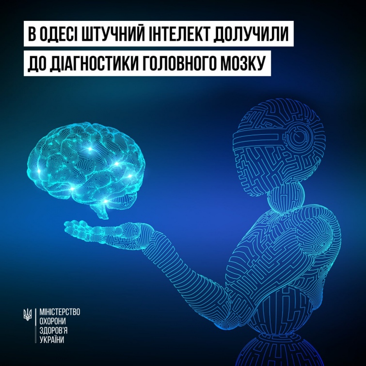 Допомагає поставити діагноз за п'ять хвилин: в Одесі вперше залучили нейромережу до діагностики головного мозку
