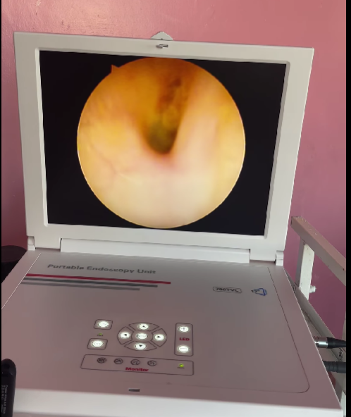 В Тарутинской центральной больнице пациенты могут воспользоваться новой услугой – эндоскопическое обследование ЛОР-органов