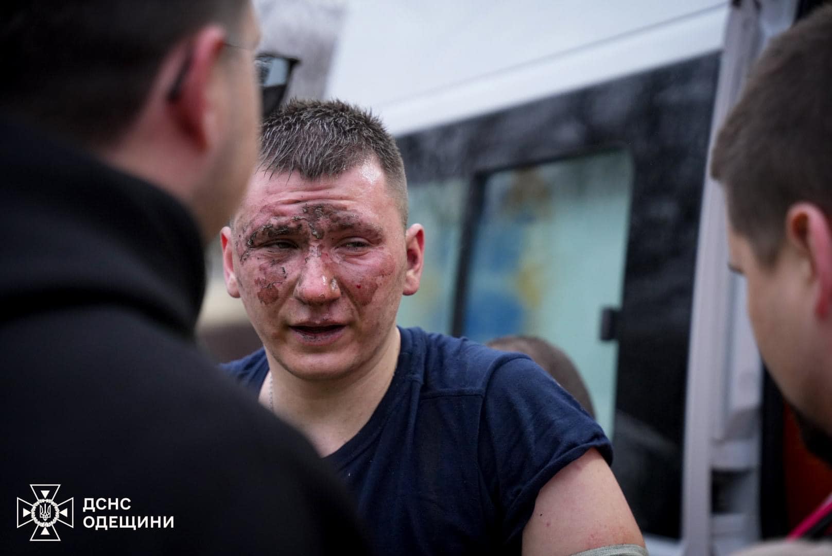 Багато руйнувань та поранених: в Одесі триває ліквідація наслідків ракетного удару ─ ДСНС