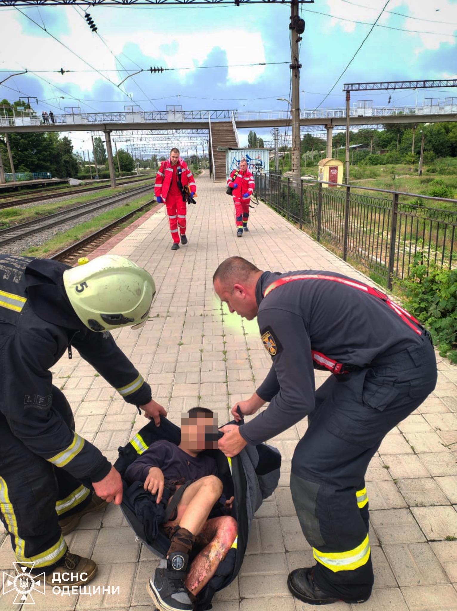 На Одещині продовжуються смертельно небезпечні флешмоби: підліток у важкому стані