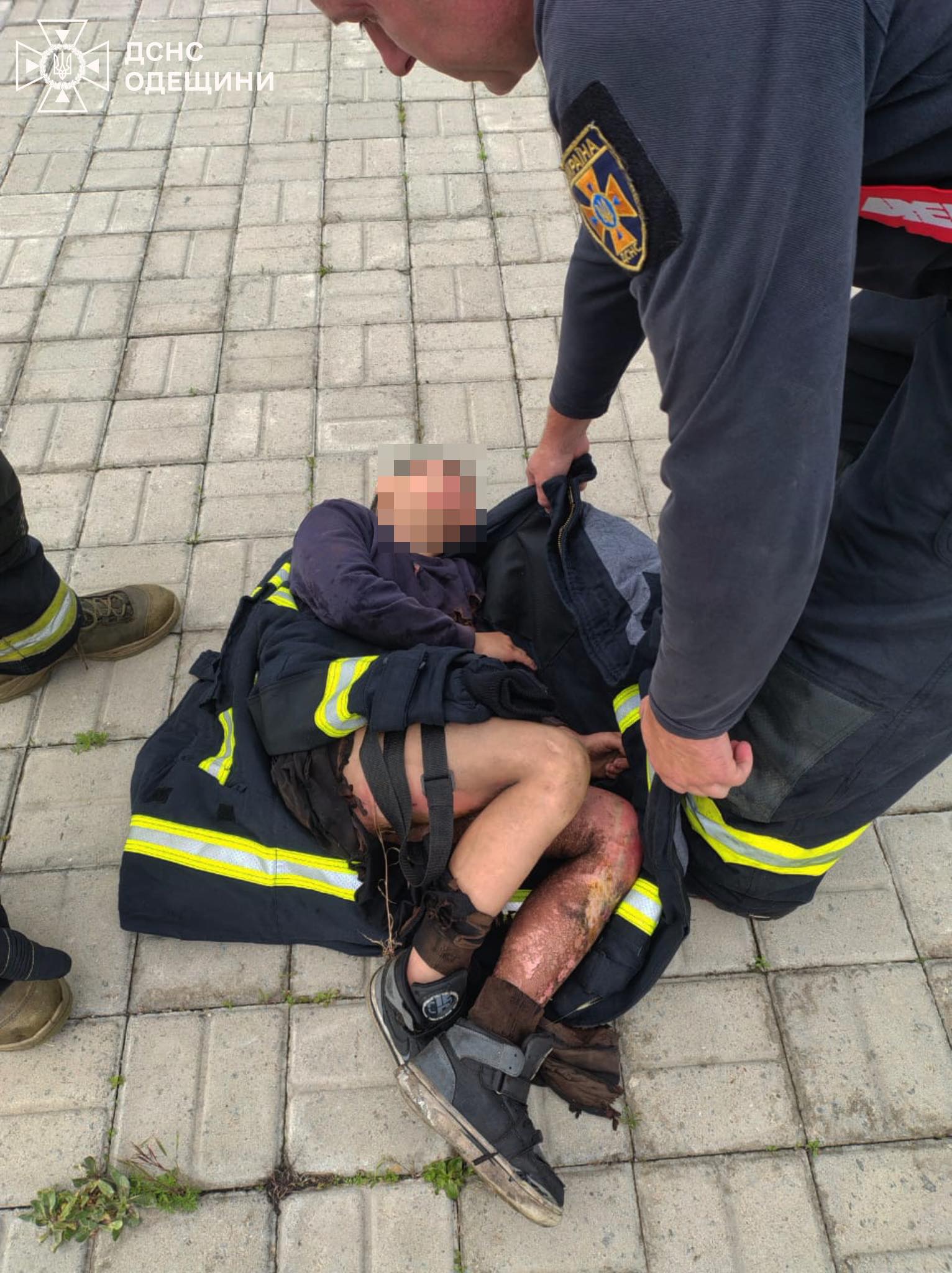 На Одещині продовжуються смертельно небезпечні флешмоби: підліток у важкому стані