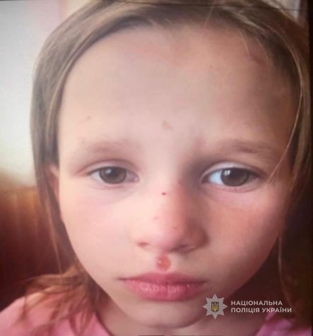 Зниклу безвісти семирічну дівчинку на Одещині знайшли мертвою: поліція встановлює обставини трагедії