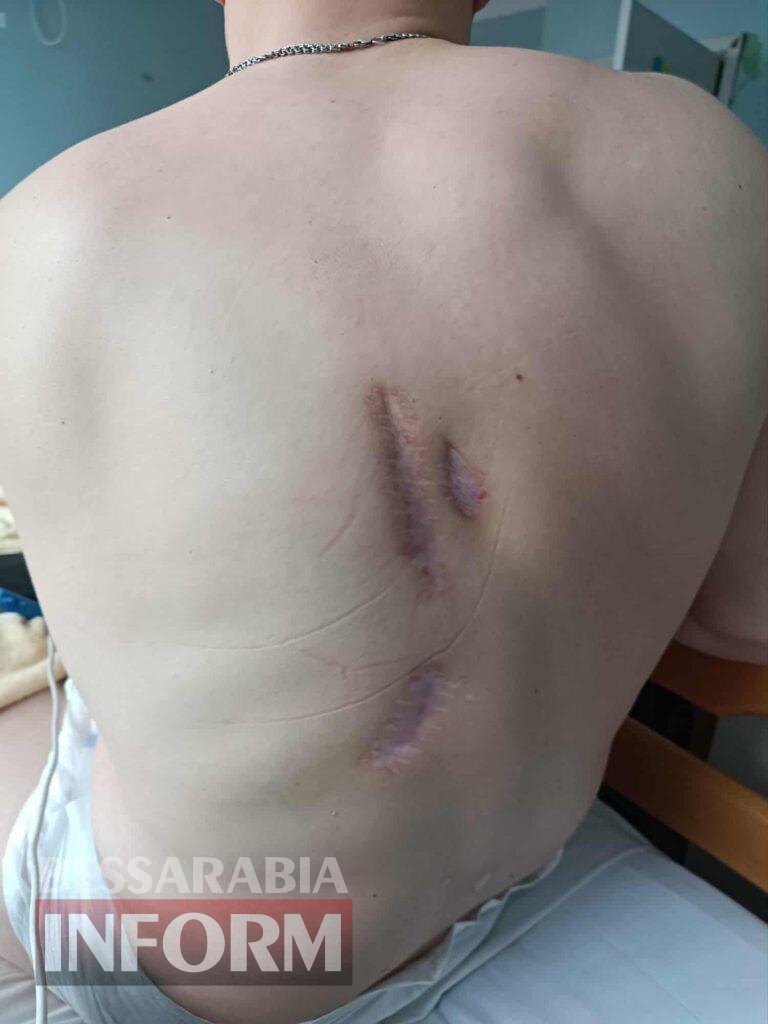 Гідно прийняти смерть, але вижити: аккерманець В'ячеслав Філіпенко - про війну та адаптацію до колісного крісла