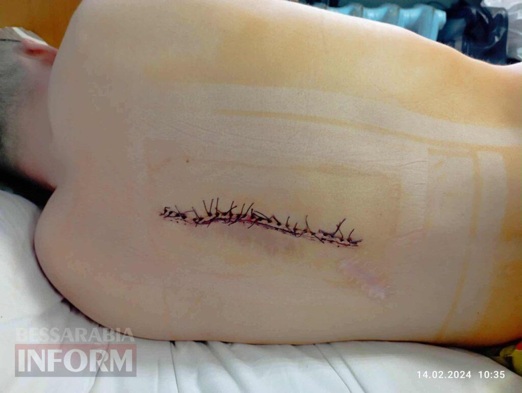 Гідно прийняти смерть, але вижити: аккерманець В'ячеслав Філіпенко - про війну та адаптацію до колісного крісла