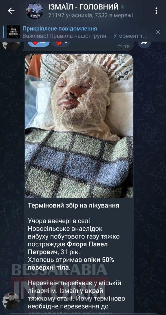 У Ренійській громаді внаслідок вибуху газового балона важкі травми отримав 31-річний чоловік