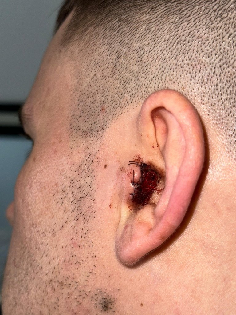 Попри поранення та важке лікування прикордонник з Одещини Андрій Шуліка повертається на фронт