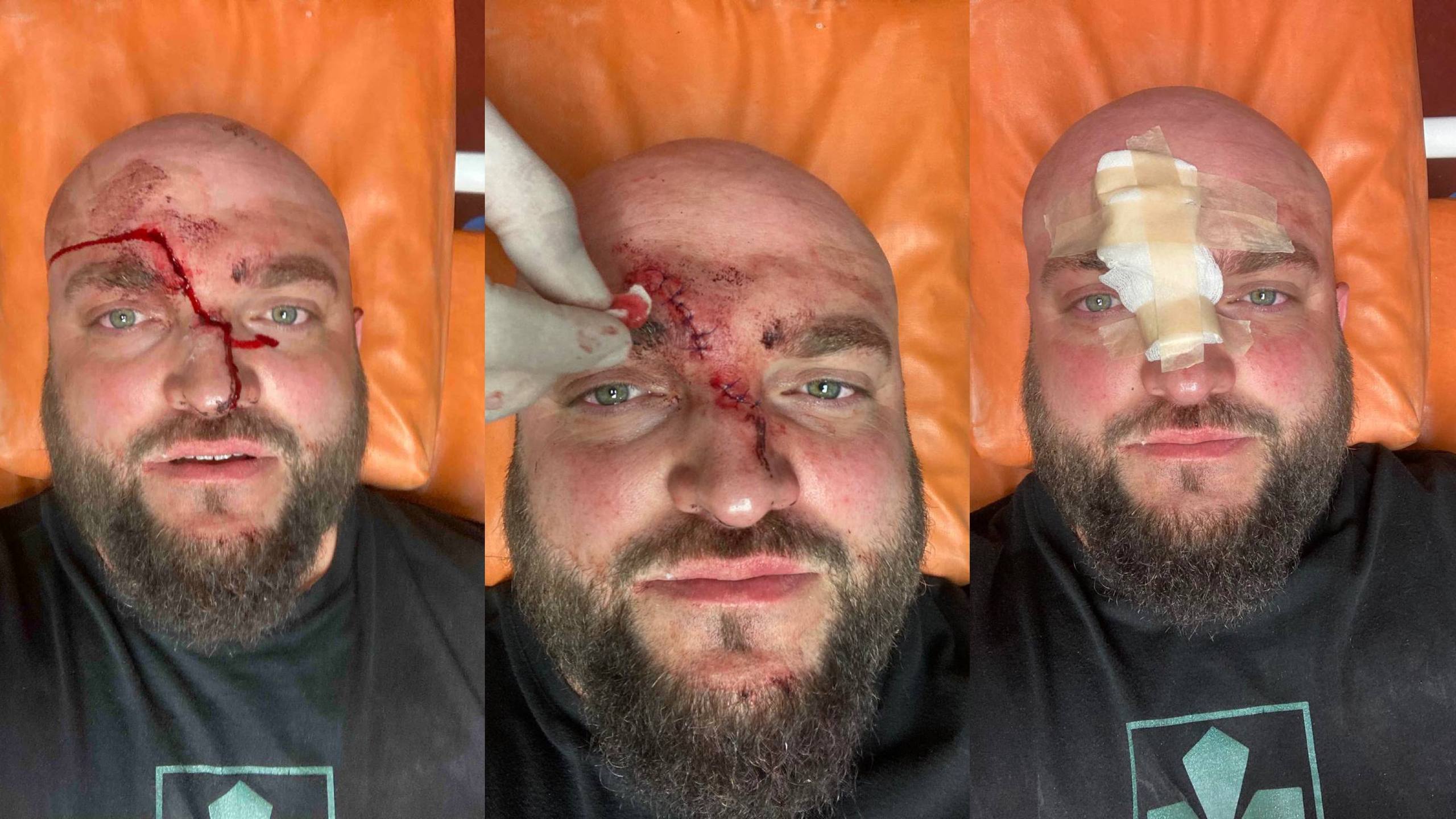 У Затоці чоловік арматурою побив військового через зауваження про російську музику