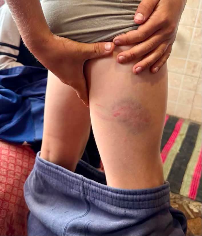 В Одеській області батько бив сімох неповнолітніх дітей через те, що вони не слухалися. Оновлено: додано фото