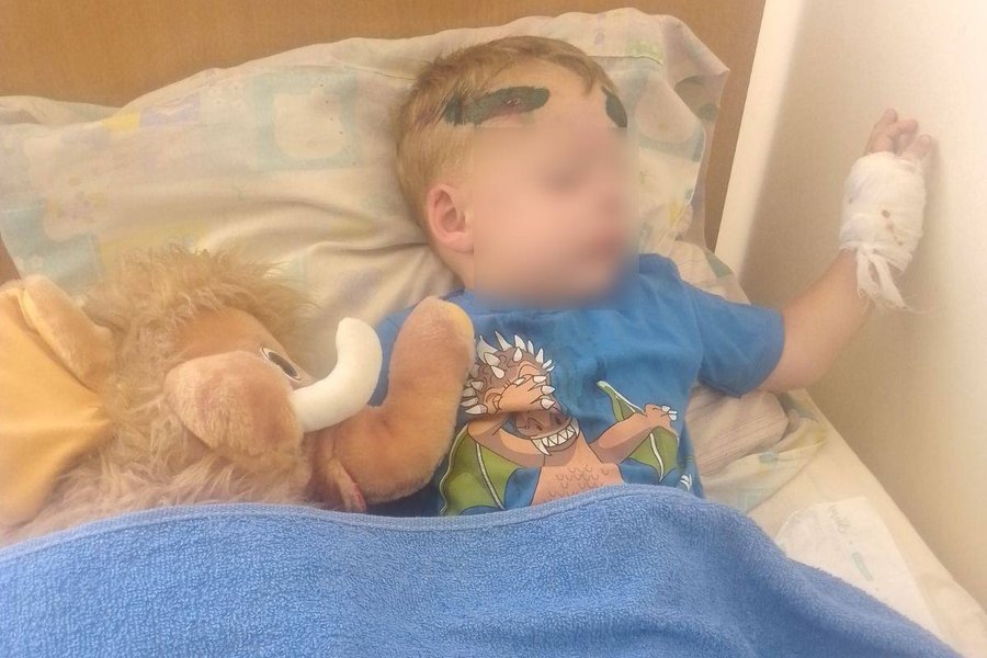 Батько дворічного хлопця, якого автівкою збив співробітник ТЦК, розповів обставини інциденту та про стан дитини