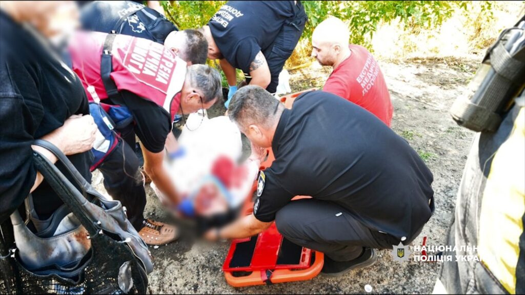 У поліції розповіли подробиці ДТП в Одеському районі, під час якої зіштовхнулися автобуси